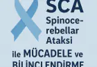Sca hastaliğinin ilerleme süreçleri..