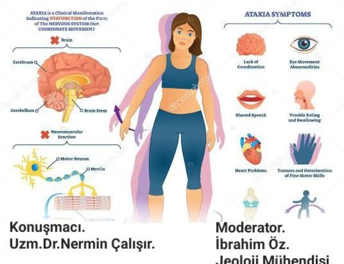 18.07.2025 19.00 Spinoserebellar Ataxia and Neurological Findings