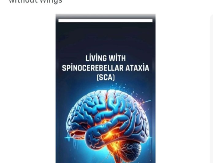 Sca tedavisi, Sca hakkında...